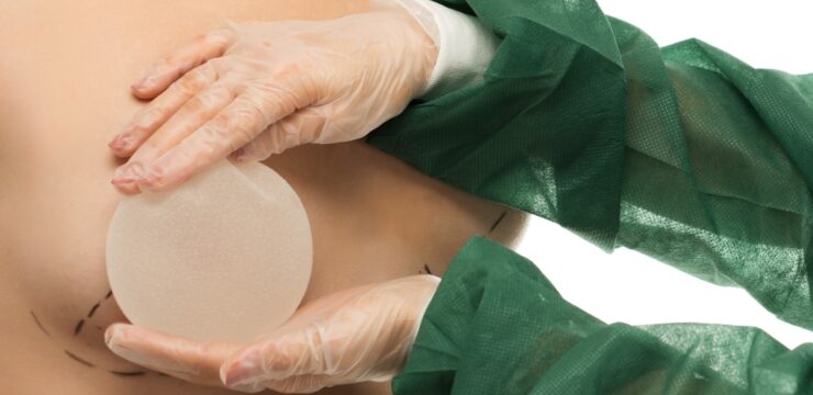 Breast Implant Placement
